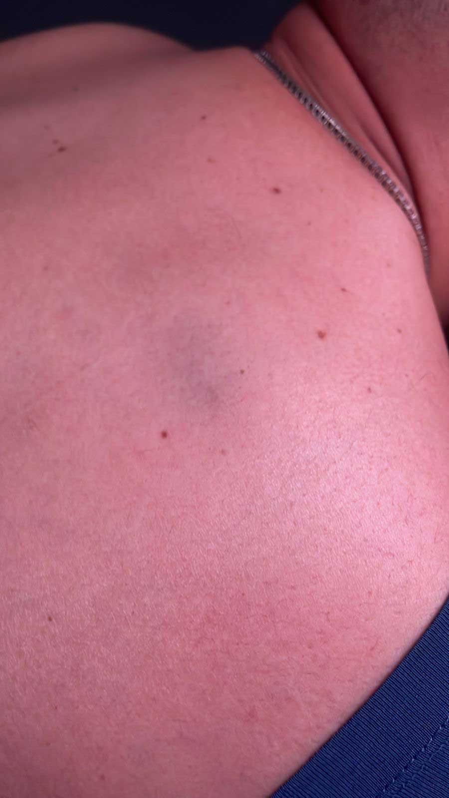 yaki-golpe-concierto