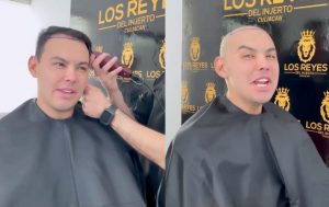 El Yaki, injerto de cabello