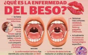 Causas y síntomas de la enfermedad del beso 