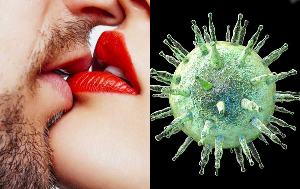 ¿Qué es la mononucleosis, la enfermedad del beso?