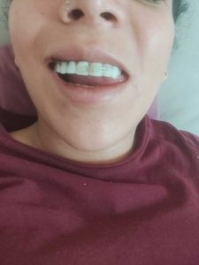 Pamela Carbajal, dientes