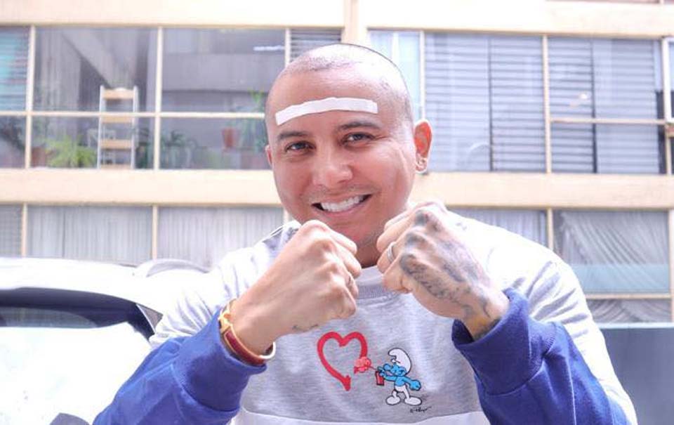 Edwin Luna se realiza trasplante de cabello ¡hay video!