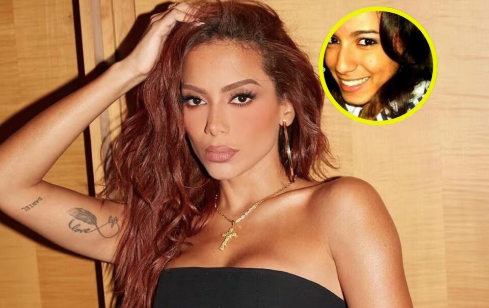Anitta antes y después de las cirugías