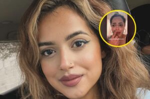 Hija de Lupillo Rivera sufre fuertes quemaduras