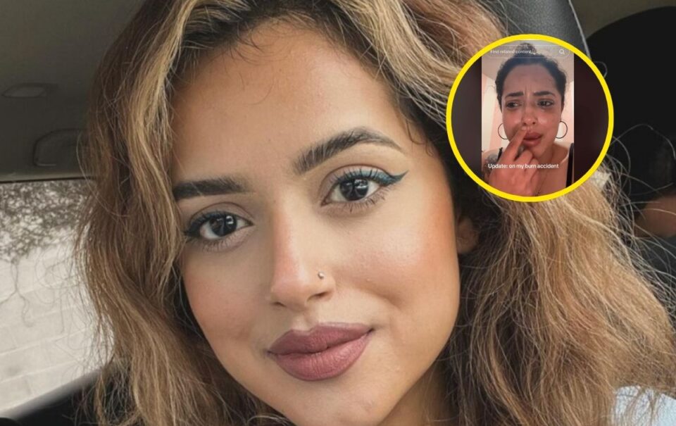 Hija de Lupillo Rivera sufre fuertes quemaduras