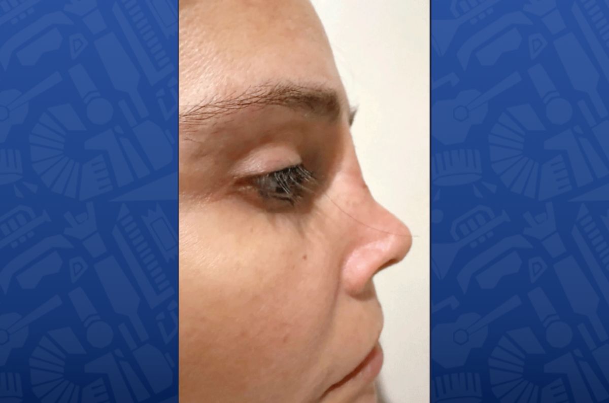 dorismar-jose-achar-cirujano-2