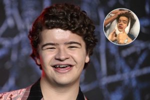 ¿Qué es la displasia cleidocraneal, afección que tiene el actor de Dustin de Stranger Things?
