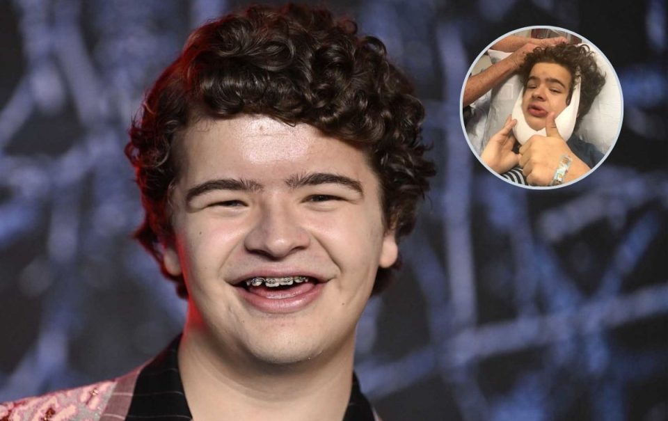 ¿Qué es la displasia cleidocraneal, afección que tiene el actor de Dustin de Stranger Things?