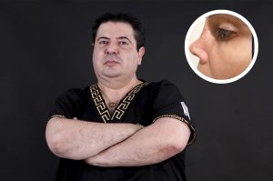 ¿Quién es José Achar, cirujano que desfiguró el rostro de Dorismar? | FOTOS