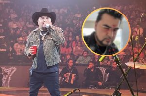 El Mimoso sube foto con golpes en la cara y alerta a fans, ¿qué le pasó?